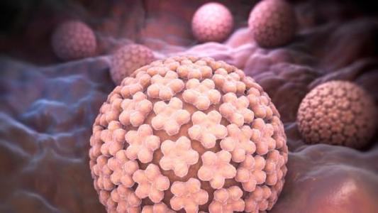 HPV是什么病？